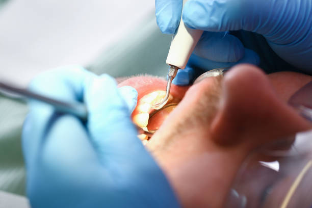 Professional Emergency Dentist in KS