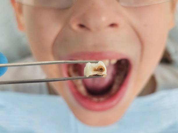 Best Emergency Dental Care for Trauma or Injury in Kinsley, KS