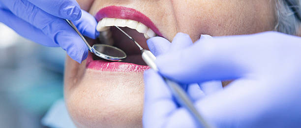 Best Emergency Tooth Extraction in Kinsley, KS
